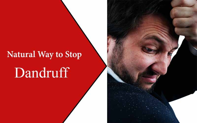 get rid of dandruff naturally
