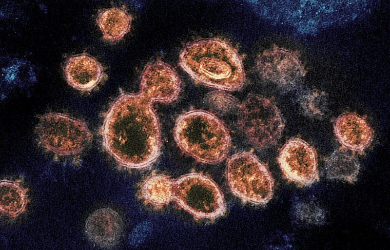 US-China spar over coronavirus origins