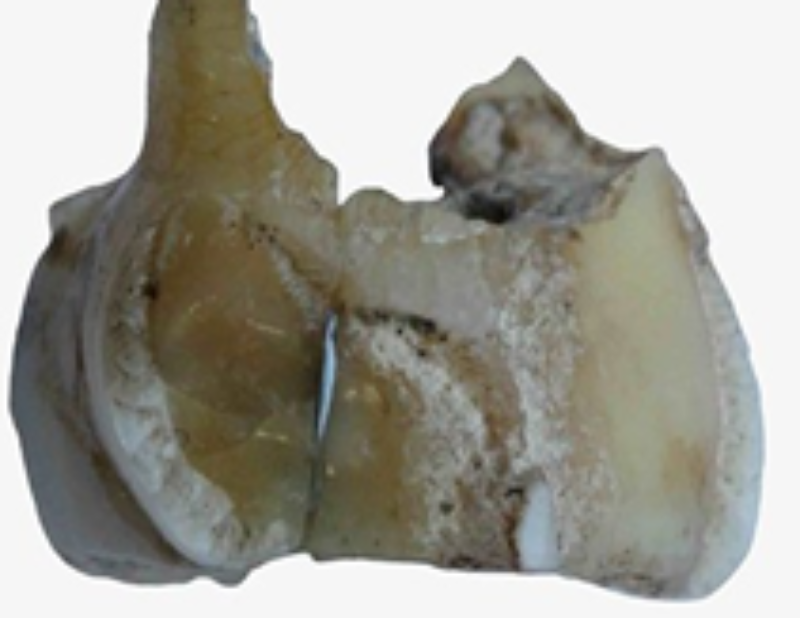 Old Tooth Piece Shows The Ancient DNA Linkage Yet To Local Americans